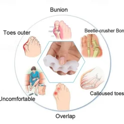 1 Pair Silicone Toes Separators Straightener Spreader Professional Soft Separator Bunion Hallux Valgus Relief Foot Care
