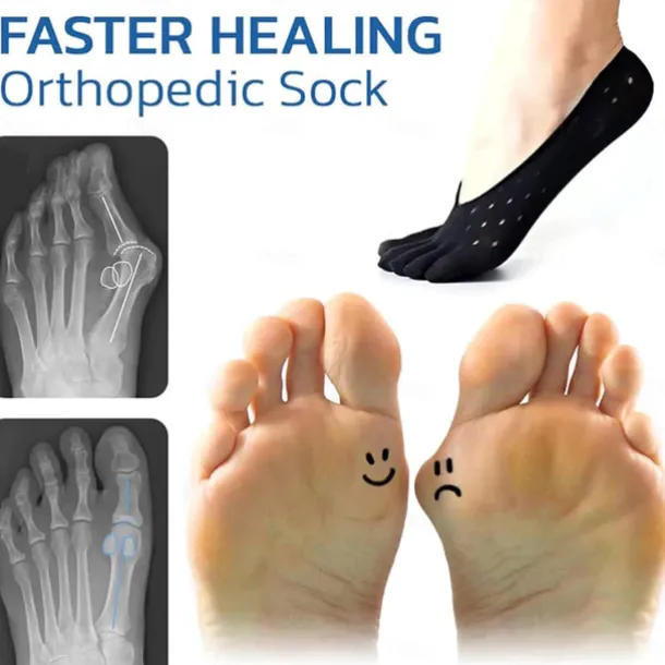 5 Pairs Orthopedic Toe Compression Sock Women's Toe Socks Projoint Antibunions Health Sock - Sock Align Toe Socks for Bunion - Anti Bunion Socks for Women and Men