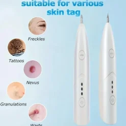 Freckle, Wart, Mole, And Skin Tag Removal Pen - Get Spotless Skin With This Beauty Care Machine