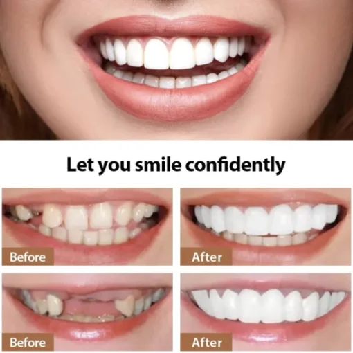 1Pack Silicone Teeth Whitening Teeth Cover Teeth Braces Simulation Denture Upper Teeth Lower Teeth Set with Box Perfect Smile