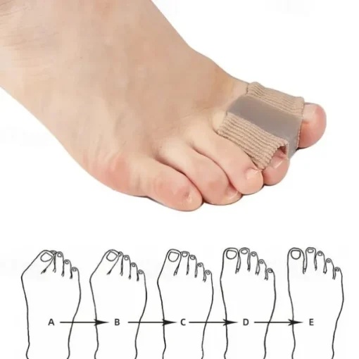 1pc Toe Spacer (0.6in/0.7in) for Toe Alignment and Comfort, Soft Gel Separator for Daily Wear