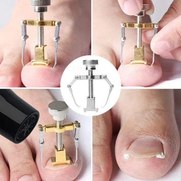 2Pcs Ingrown Toenails Corrector Stainless Steel Nail Straightening Tool Relief Pain Pedicure Tool For Ingrown Toenail Recover