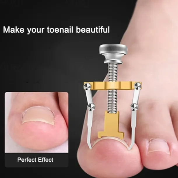 2Pcs Ingrown Toenails Corrector Stainless Steel Nail Straightening Tool Relief Pain Pedicure Tool For Ingrown Toenail Recover