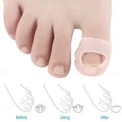 2PCS Silicone Ingrown Toenail Corrector – Invisible Toe Nail Straightening Brace, Pedicure Foot Care Tool for Paronychia Treatment & Nail Healing Protection