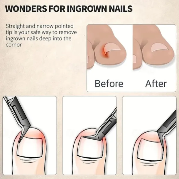 Stainless Steel Toenail Clippers with Sharp Pointed Tip for Ingrown and Thick Nails - Wide Jaw Podiatry Care Tool