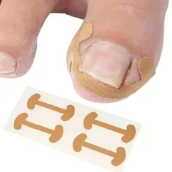 Toenail Correction Patches - 10 Sheets of Ingrown Nail Correction Bone Patch, 40pcs/set Toenail Correction Patches